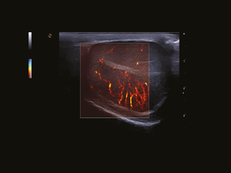 dtlmedical_ecograf_MyLabOmegaeXP_vet_ecografie_high-freq-probes_img5