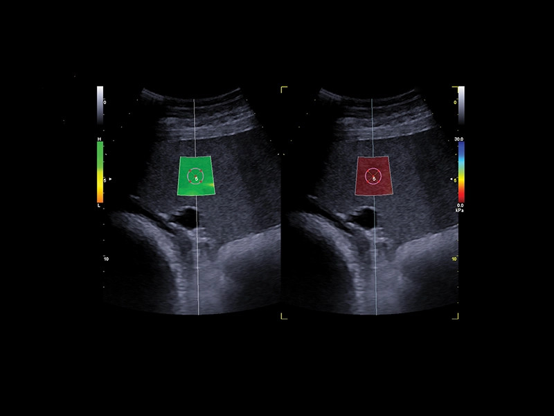 dtlmedical_ecograf_esaote_MyPanther_imagine_clinica_6