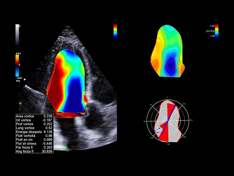 dtlmedical_esaote_ecograf_MyLabE80_HyperDoppler