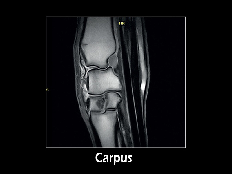 dtlmedical_esaote_RMN_G-scan_equin_carpus1