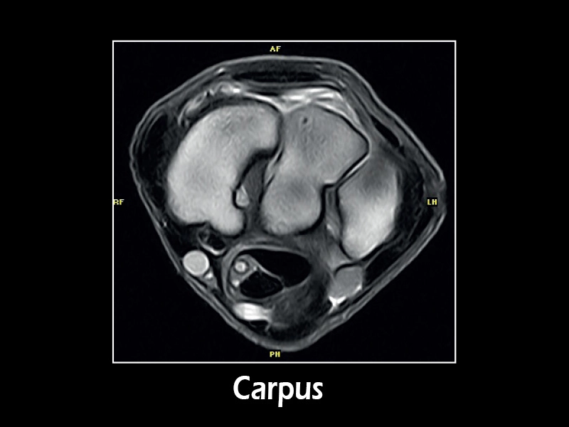 dtlmedical_esaote_RMN_G-scan_equin_carpus2