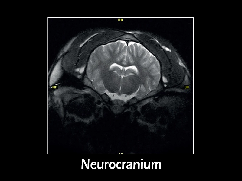 dtlmedical_esaote_RMN_G-scan_equin_neurocranium