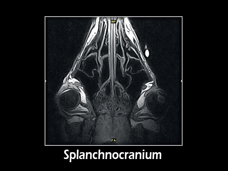 dtlmedical_esaote_RMN_G-scan_equin_splanchnocranium