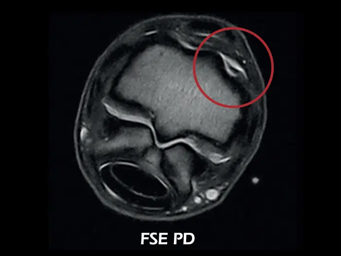 dtlmedical_esaote_rmn-o-scan-vet_rmn_imagine_clinica_artropatie