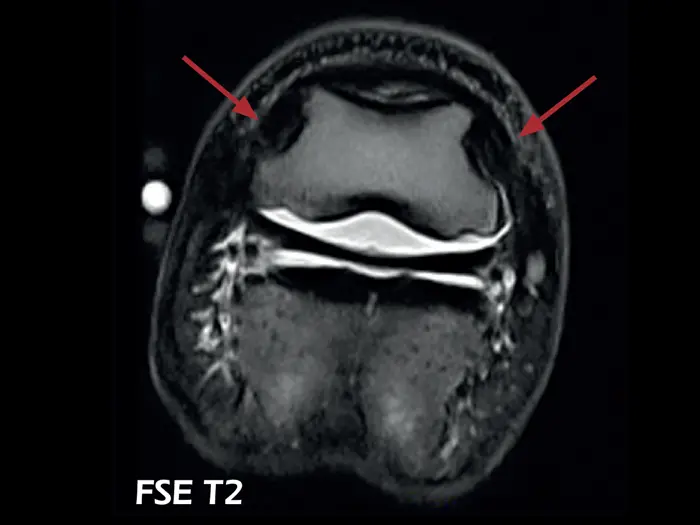 dtlmedical_esaote_rmn-o-scan-vet_rmn_imagine_clinica_genunchi