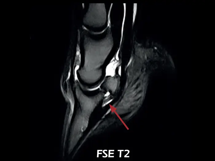 dtlmedical_esaote_rmn-o-scan-vet_rmn_imagine_clinica_genunchi_lateral