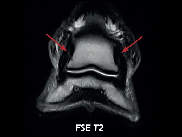 dtlmedical_esaote_rmn-o-scan-vet_rmn_imagine_clinica_ligament